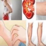 ¿Tus Riñones Están Fallando? 10 Señales Silenciosas que No Debes Ignorar