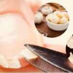 El Remedio Casero Definitivo: ¡Ajo y su Poder Contra los Hongos en las Uñas!