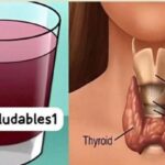 ¿Sufres de Tiroides? Descubre Cómo Puedes Curarte en Casa