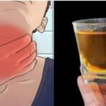 Chau al Dolor de Garganta e Inflamación: El Poder de los Antibióticos Naturales