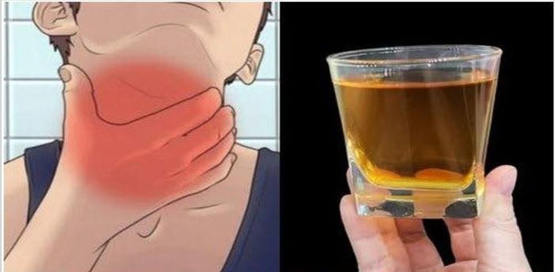 Antibióticos naturales para el dolor de garganta