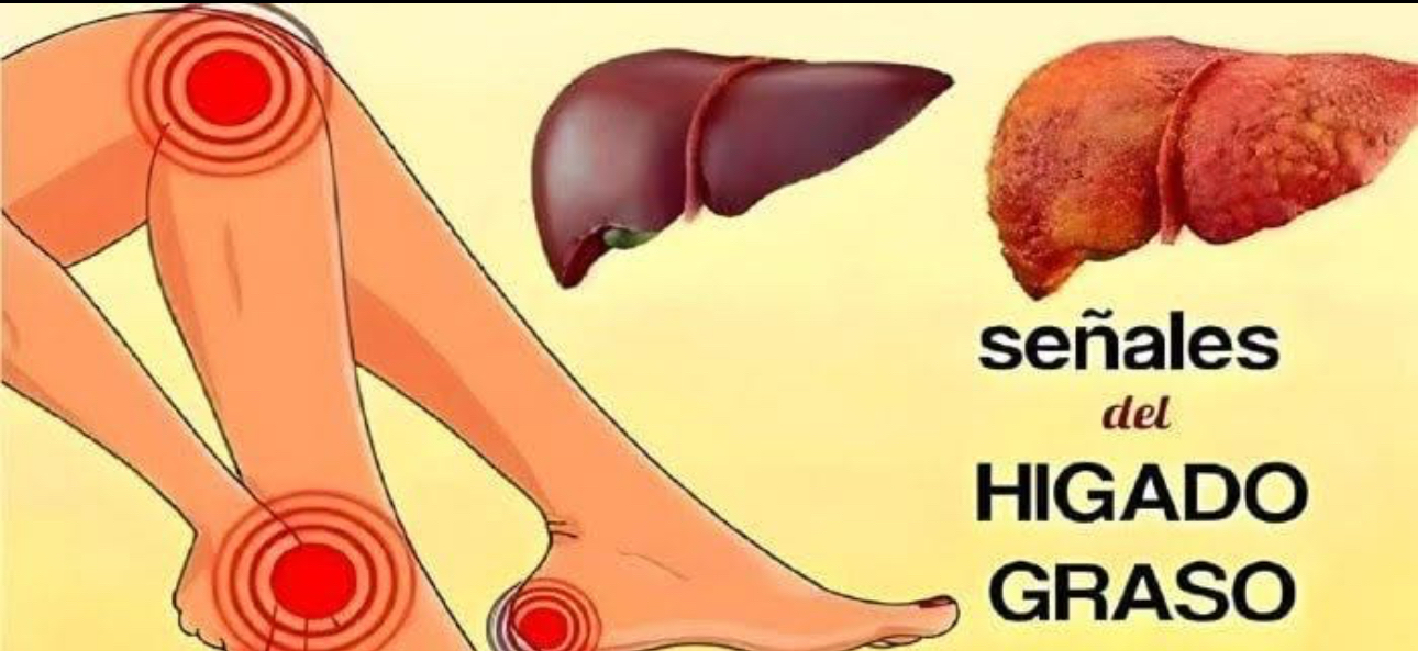Hígado Saludable