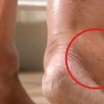 Sabías que los pies hinchados pueden ser por estas diferentes causas. Ten cuidado