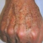¿Sabías que las manchas en las manos pueden ser una señal de problemas de salud?