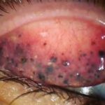 Las Consecuencias de Dormir con Maquillaje: ¡Cuidado con Tu Piel!