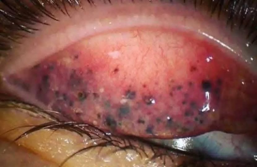 Consecuencias de dormir con maquillaje