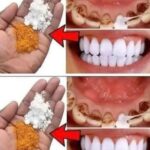 Descubre el Método de Blanqueamiento Dental en Solo 2 Minutos