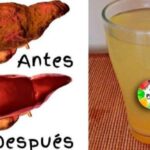 Revitaliza Tu Hígado: Secretos para Mantener su Juventud y Vitalidad
