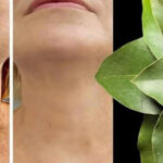 El Laurel: Un Potente Remedio Natural Contra las Arrugas