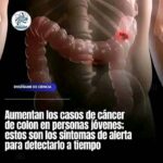 Síntomas del Cáncer de Colon: Lo Que Debes Saber