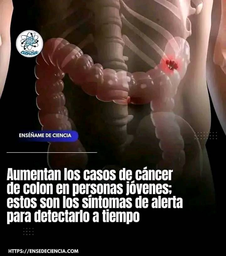 Síntomas del cáncer de colon