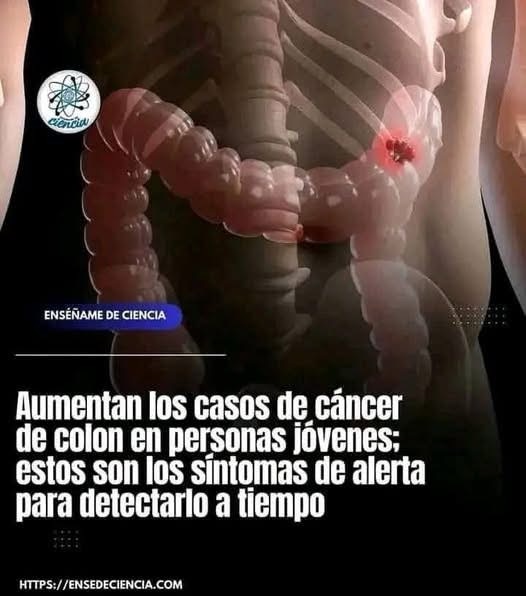Cáncer de colon