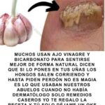 Elimina los Hongos de tus Uñas Con Este Sencillo Truco