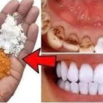 Los Secretos Ocultos de los Dentistas: Blanqueamiento Dental en Solo 2 Minutos