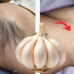 ¡Deja de Afeitarte! Descubre Cómo Deshacerte del Vello Facial y Corporal de Forma Permanente