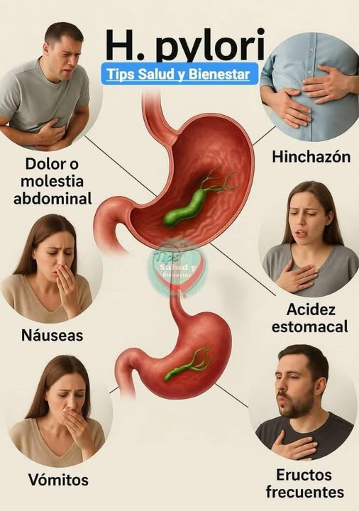 Diagrama informativo sobre Helicobacter pylori