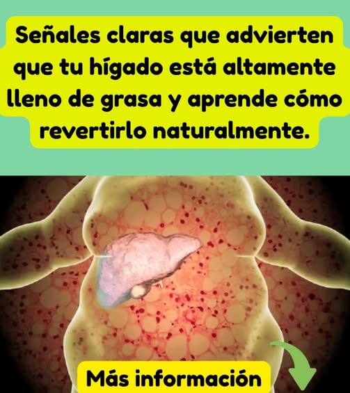 Ilustración del hígado