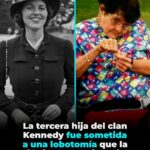 🕯️ El secreto trágico de Rosemary Kennedy: la lobotomía que marcó a una de las familias más poderosas del mundo